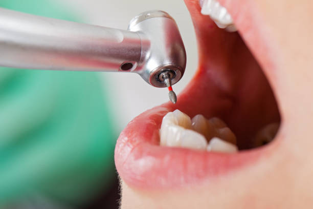 Best Mobile Emergency Dentist in Shell Kno, MO